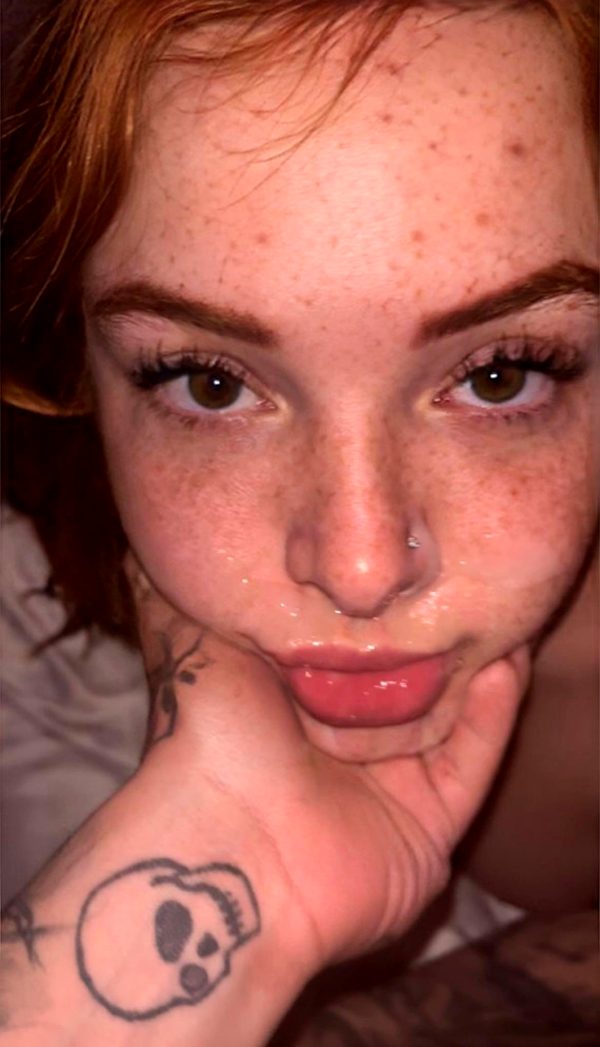 nut-on-a-gingers-freckles_001